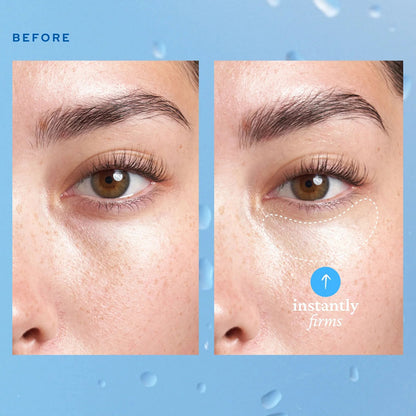 Last 3 Hours to Save! Aqua Bomb Eye Gel - Hydrates & Brightness | Fights Dark Circles  & Fine Line